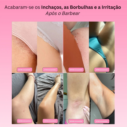 Deslizamento Íntimo Nirevas
