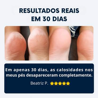 Lima de Pies Eléctrica Profesional