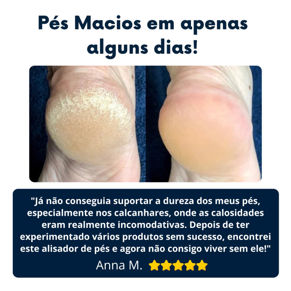 Lima de Pies Eléctrica Profesional